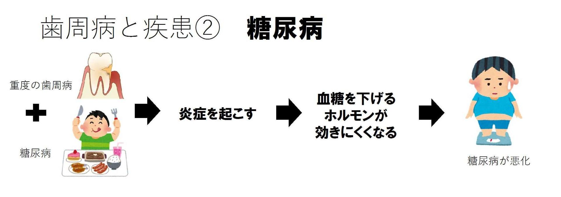 歯周病と糖尿病の関係性